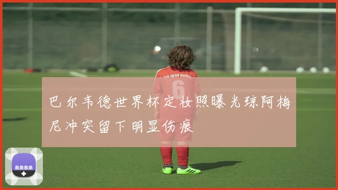 巴尔韦德世界杯定妆照曝光琼阿梅尼冲突留下明显伤痕